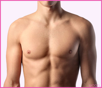 Pectoral Implants for Men