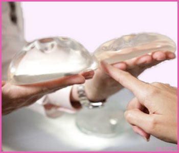 breast-implant