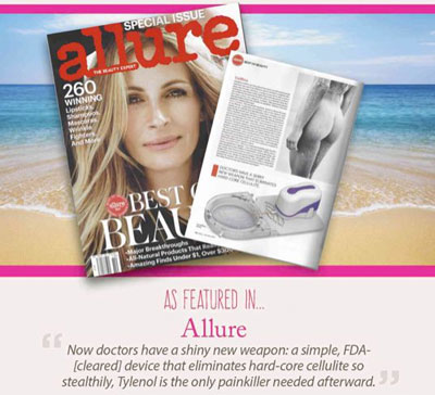 allure-