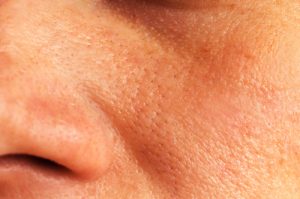 Facial Pores by Nose