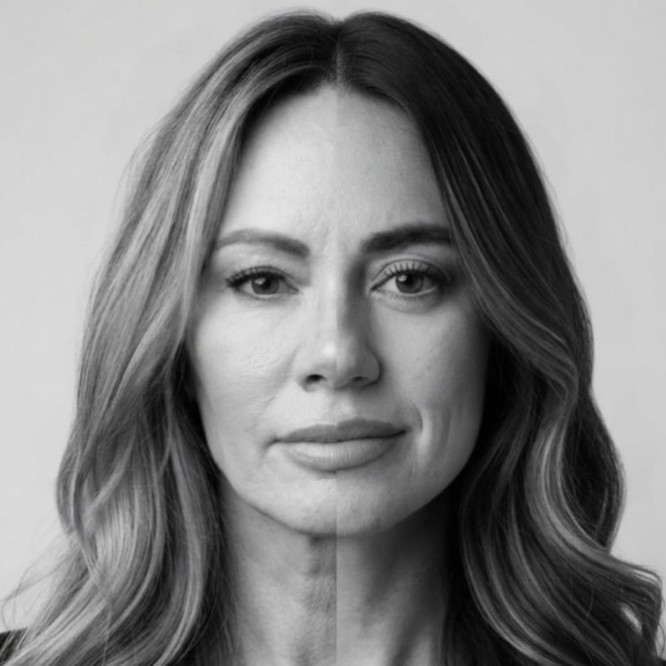 Black and white composite portrait joining half of a mother's face and half of her daughter's face down the midline, both with long wavy hair. The mother had a facelift with Dr. Frank Agullo at Southwest Plastic Surgery almost ten years earlier. Shared with permission.